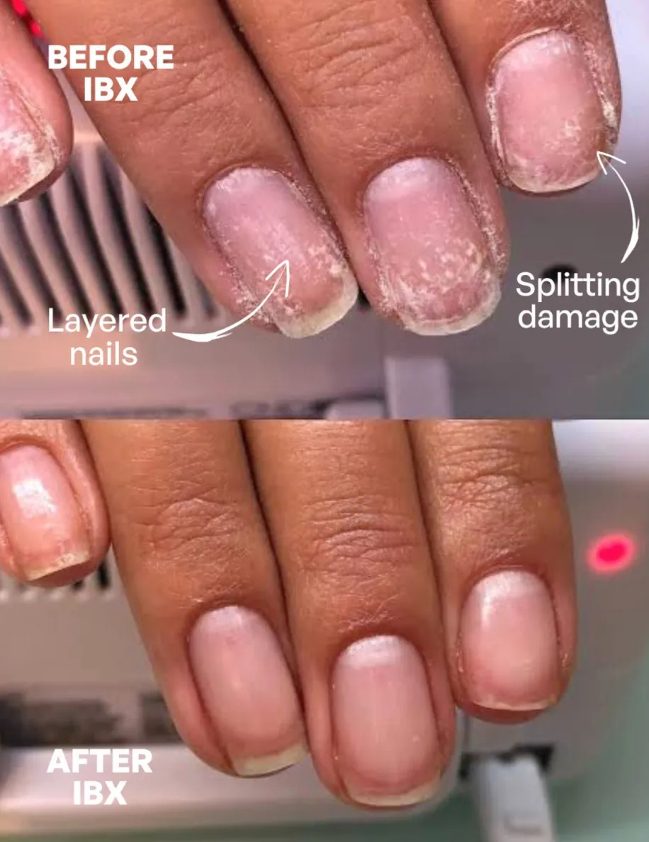 IBX recovery manicure