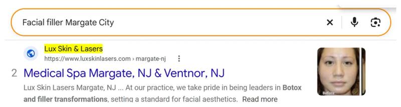 Google result 2: Lux Skin Lasers for Facial filler Margate City