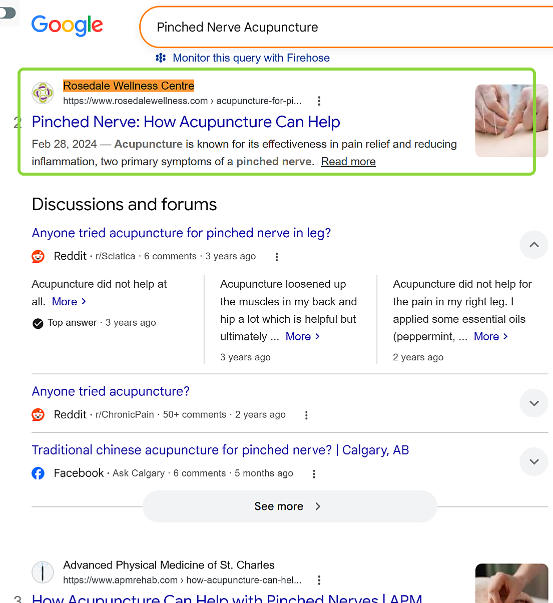 Google result showing Rosedale Wellness Centre second for pinched nerve acupuncture