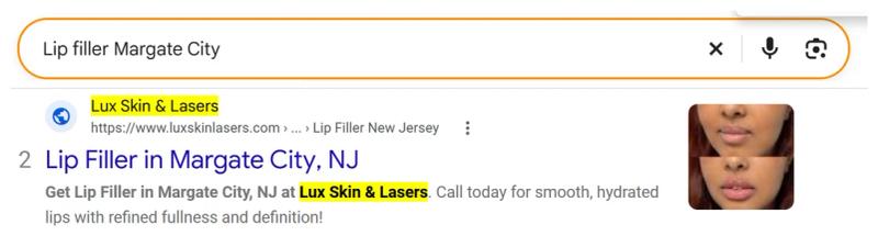 Google result 2: Lux Skin Lasers for Lip filler Margate City