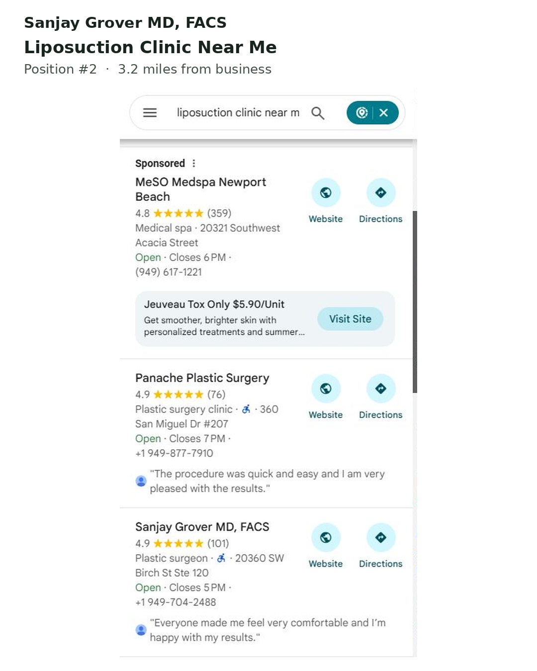 Google Maps results for liposuction clinic near me: a sponsored med spa, Panache Plastic Surgery, then Sanjay Grover MD, FACS with 4.9 stars from 101 reviews